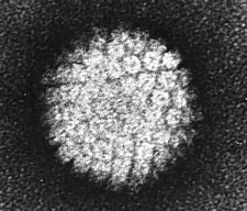 Human papillomavirus