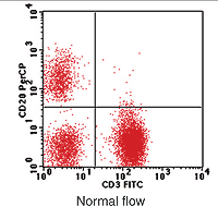 Lymphocyte phenotyping by flow cytometry for a patient with normal T, B and NK cells