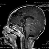 Figure 2: Child's cough persisted for more than 30 seconds