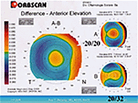 height maps