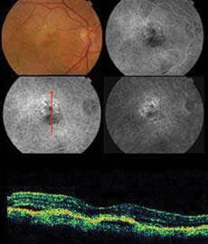 Case 2a