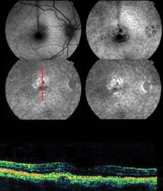 Case 2b