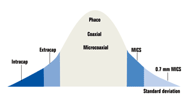 Gaussian distribution of cataract surgery