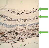 Arrows show where PDE5 is diffused