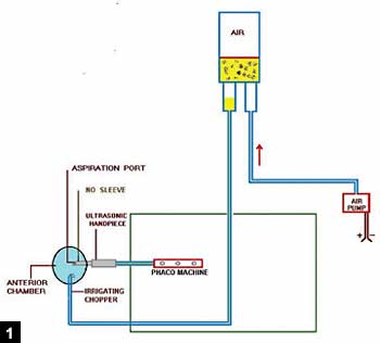 Figure 1: Diagrammatic representation of the connection of air pump to infusion bottle