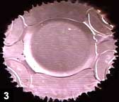 Figure 3: In vitro eye bank eye implanted with closed-loop IOL