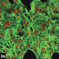 Figure 2a.  Effects of 15 minutes of contact of BAK on conjunctival cells in vitro