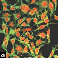 Figure 2b.  Conjunctival cells in vitro