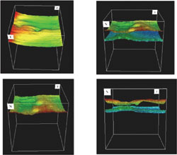 Tridimensional topography retinal map protocols of the macular area