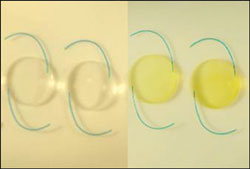 The optic of the Smart Yellow/Matrix Acrylic Aurium IOL (Medennium) changes from colorless to yellow upon exposure to UV light.