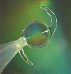 Figure 1: Achromatizing lens design.