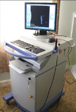 Marvel B-scan with UBM (Appasamy Medical Equipment Pvt. Ltd., India) was used at 3 months to determine positioning of device.