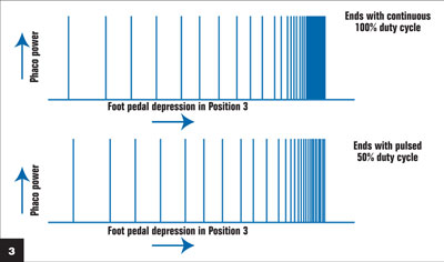 Figure 3: End point in phaco burst