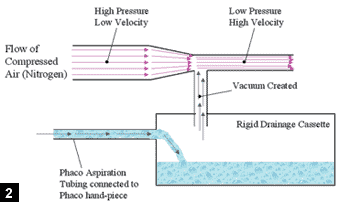 Figure 2: The vacuum level is created within a rigid drainage cassette, to which the phaco aspiration tubing is connected