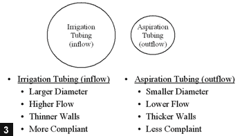 Figure 3: Note the differences in irrigation inflow tubing and aspiration outflow tubing