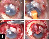 Figure 3: Extensive OSSN