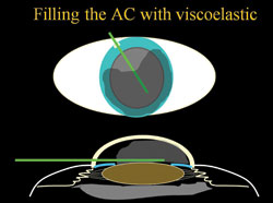 Figure 1. At the beginning of surgery