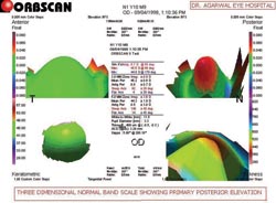 Figura 3. Mapa de escala de banda normal tridimensional.