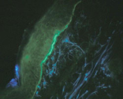 Figura 1. Imunofluorescência da pele da membrana basal.