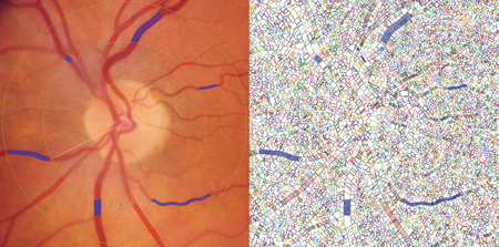 Side-by-side view of the color fundus and the splats with vessels drawn.