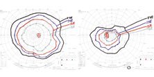 Visual field in the left eye showed severe generalized constriction with near wipeout of the superior visual field.