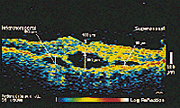 OCT map