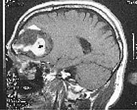 Sagittal scan