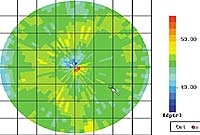 topography