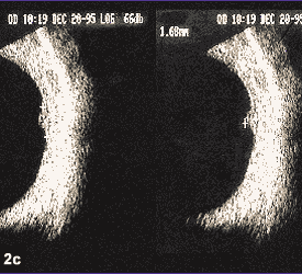 figure 2c