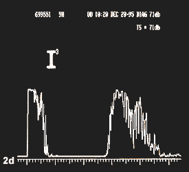 figure 2d