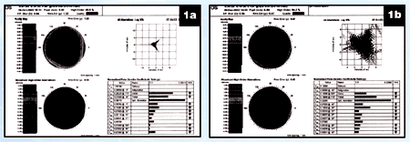 Figure 1a and 1b