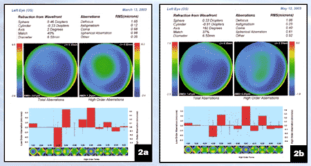 Figure 2a and 2b