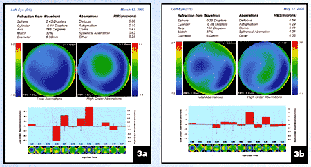 Figure 3a and 3b