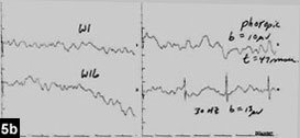 Figure 5b