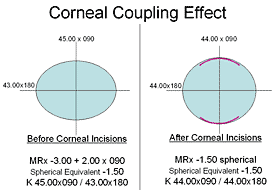 Corneal Coupling Effect