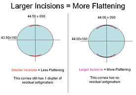 Larger Incisions = More Flattening