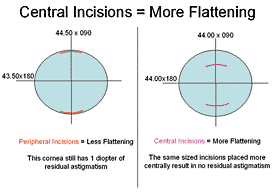 Central Incisions = More Flattening