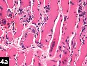 Figure 4a: Histopathologic slide showing muscle fibers and chornic inflammatory cells