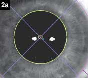 Figure 2a: Diagnostic measurement (mesopic)