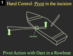 Figure 1: Hand Control: Pivot in the incision