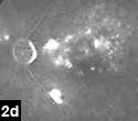 Figure 2d: Multiple pinpoint areas of hyperfluorescence