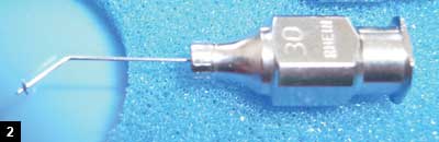 Figure 2: Ide DSAEK cannula with stopper