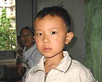 Chinese boy with eye pain treated traditionally