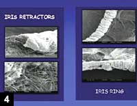 Figure 4: Scanning electron microscopy of the iris with the ring compared with iris hooks