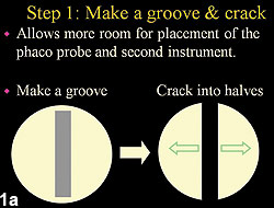 Figure 1a: Stop and chop technique