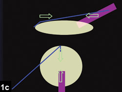 Figure 1c: Stop and chop technique