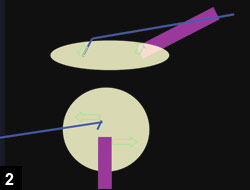 Figure 2: Vertical chopping is an effective and safe technique 