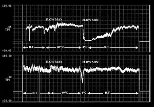 Studies in vasospastic patients and nonvasospastic patients highlight that blood flow in the neuroretinal rim is more sensitive to changes in IOP in vasospastic patients.