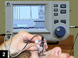 Figure 2: Technique of performing immersion A-scan ultrasound using the Accutome A-Scan Plus