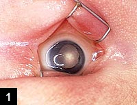 Figure 1: Anterior segment photo, left eye